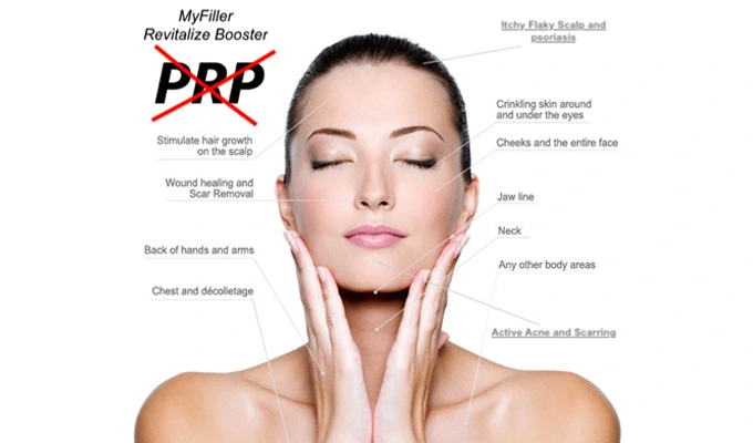 PRP Free MyFiller Revitalize Booster